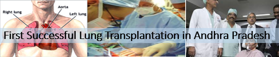 First Successful Lung Transplantation in Andhra Pradesh
