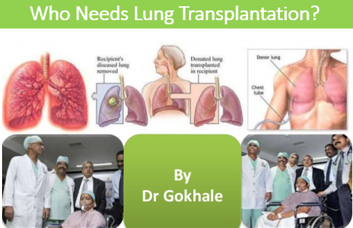 Who Needs Lung Transplantation by Dr Gokhale