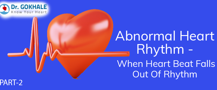 Abnormal Heart Rhythm: Symptoms & Treatment Options – Part 2