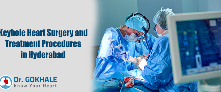 Keyhole Heart Surgery and Treatment Procedures in Hyderabad