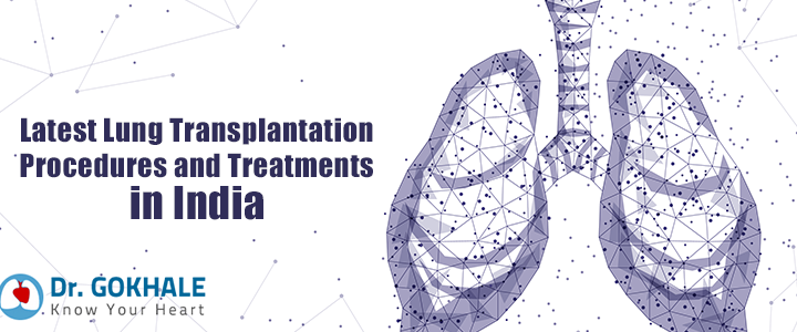 Latest Lung Transplantation Procedures and Treatments in India