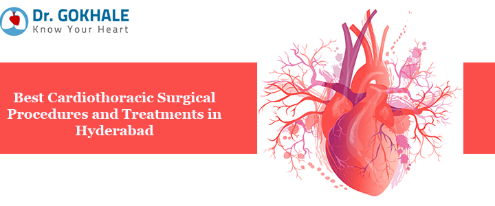 Best Cardiothoracic Surgical Procedures and Treatments in Hyderabad