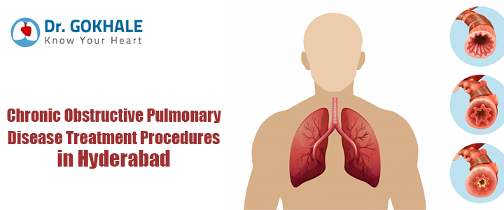 Chronic Obstructive Pulmonary Disease Treatment Procedures in Hyderabad