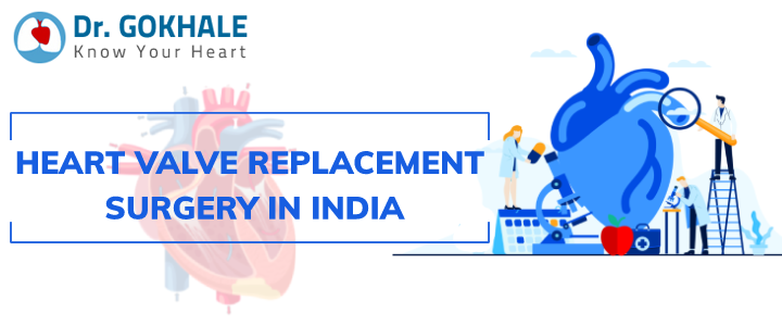 Heart Valve Replacement Surgery in India