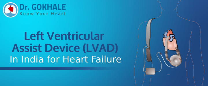 Left Ventricular Assist Device (LVAD) In India for Heart Failure | Dr Gokhale