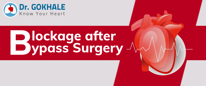 Blockage after Bypass Surgery