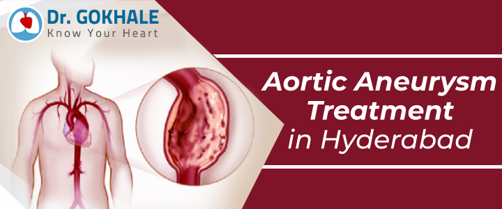 Aortic Aneurysm Treatment in Hyderabad
