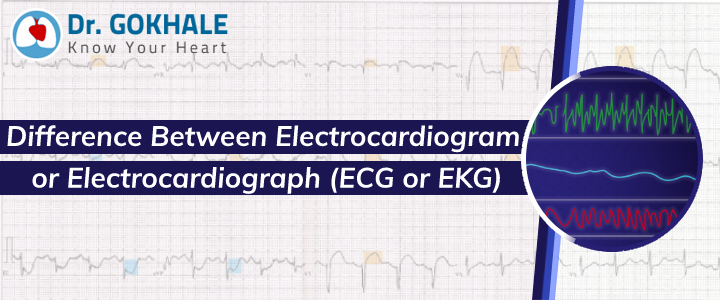 Difference Between Electrocardiogram or Electrocardiograph (ECG or EKG)