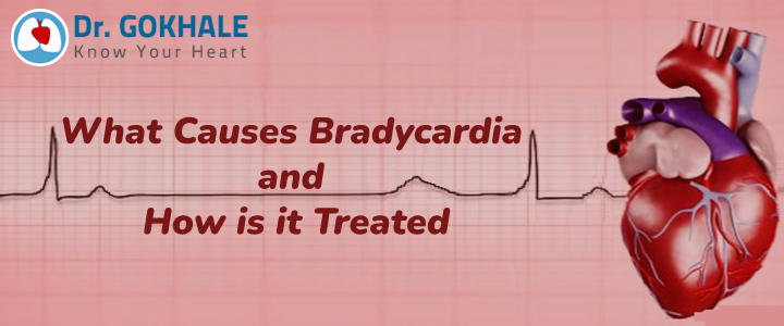 what causes bradycardia and how is it treated