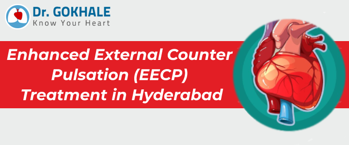 Enhanced External Counter Pulsation (EECP) Treatment in Hyderabad