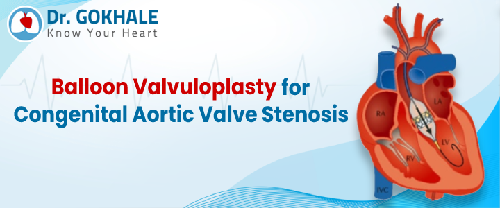 Balloon Valvuloplasty for Congenital Aortic Valve Stenosis