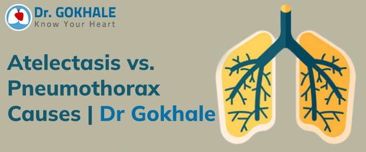 Atelectasis vs. Pneumothorax Causes | Dr Gokhale