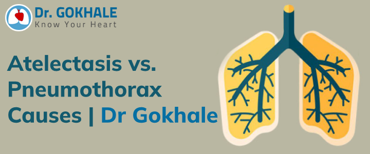 Atelectasis vs. Pneumothorax Causes