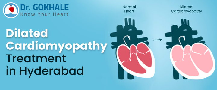 Dilated Cardiomyopathy Treatment in Hyderabad | Dr Gokhale