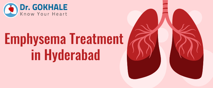 Emphysema Treatment in Hyderabad