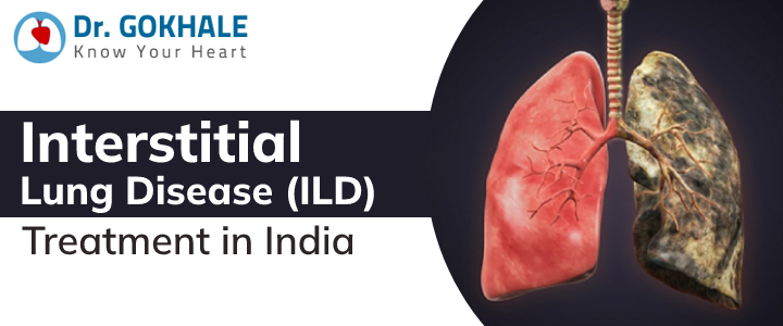 Interstitial Lung Disease (ILD) Treatment in India