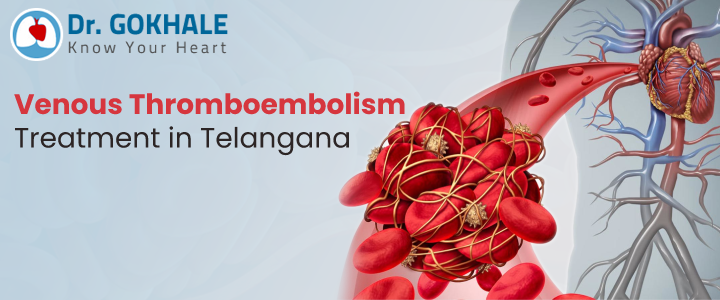 Venous Thromboembolism Treatment in Telangana