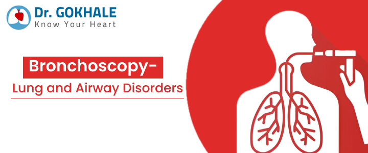 Bronchoscopy- Lung and Airway Disorders