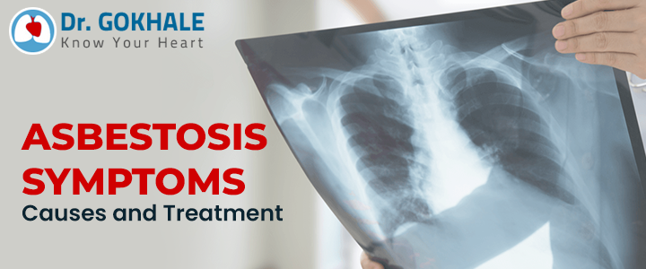 Asbestosis Symptoms Causes and Treatment