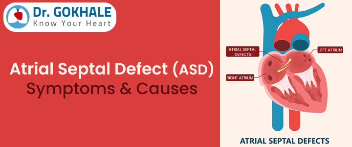 Atrial Septal Defect (ASD) Symptoms & Causes