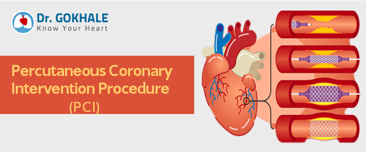 percutaneous coronary intervention pci procedure dr gokhale