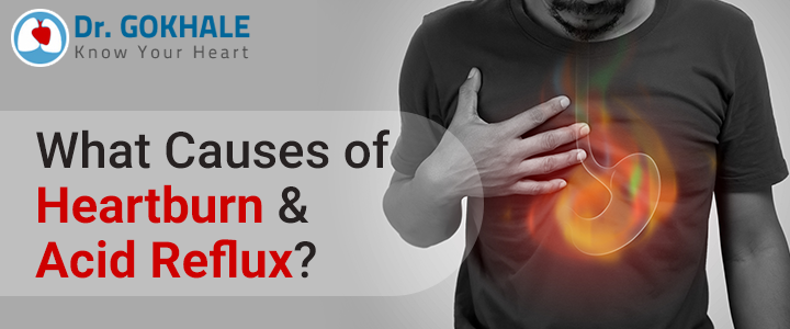 What Causes of Heartburn & Acid Reflux?