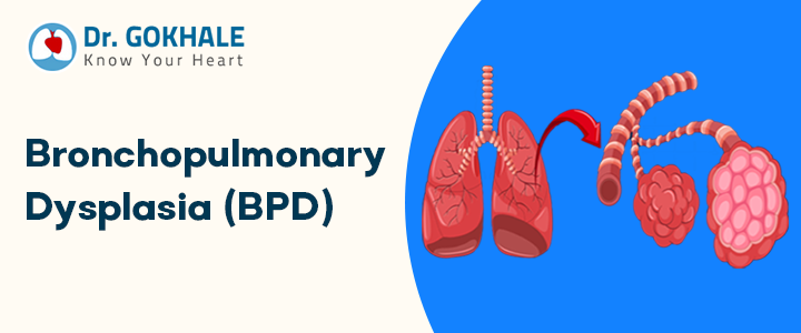 what is bronchopulmonary dysplasia bpd dr gokhale