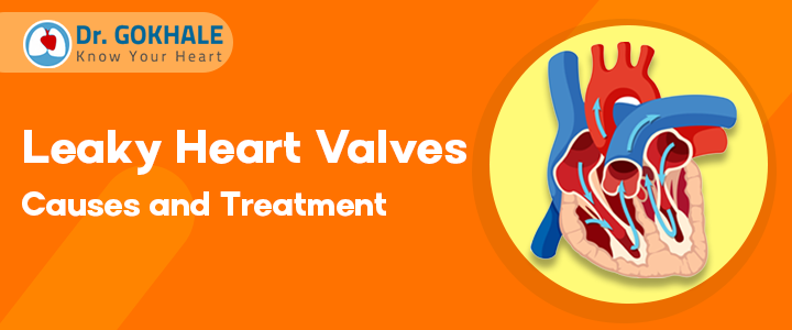 Leaky Heart Valves Causes and Treatment