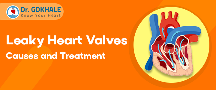 leaky heart valves causes and treatment dr gokhale