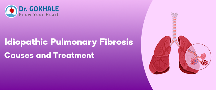 Idiopathic Pulmonary Fibrosis Causes and Treatment