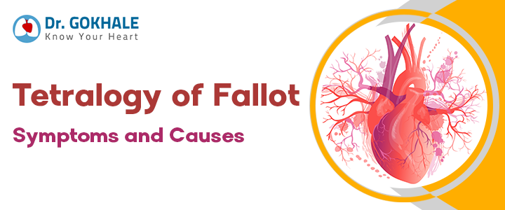 Tetralogy of Fallot Symptoms and Causes