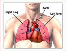 Heart and Lung Transplantation Image