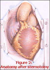 Anatomy after Sternotomy