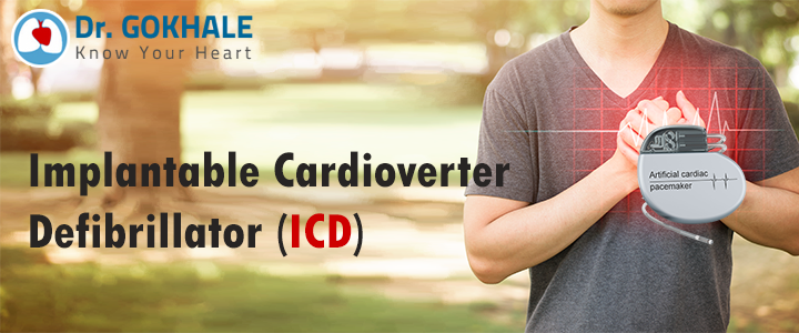Implantable Cardioverter Defibrillator (ICD) | Dr Gokhale