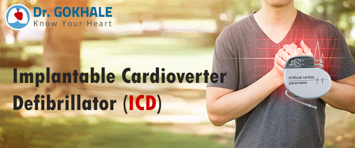 Implantable Cardioverter Defibrillator (ICD)