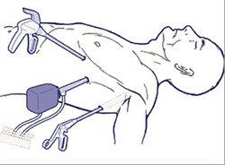 thoracoscopic surgery lung