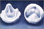 Tissue Valves