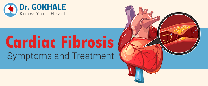 Cardiac Fibrosis Symptoms and Treatment