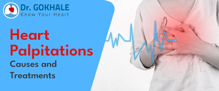 Heart Palpitations Causes and Treatments