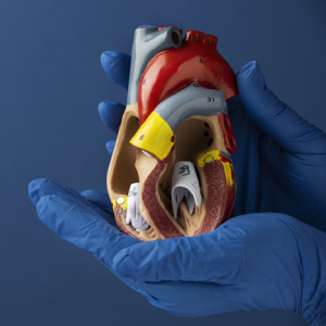 Minimally Invasive Cardiac Surgery in Hyderabad