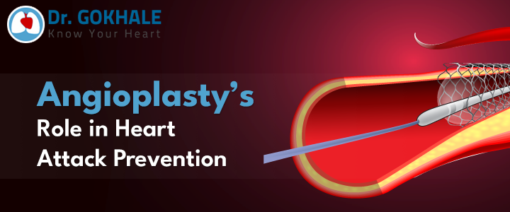 Angioplasty’s Role in Heart Attack Prevention | Dr Gokhale