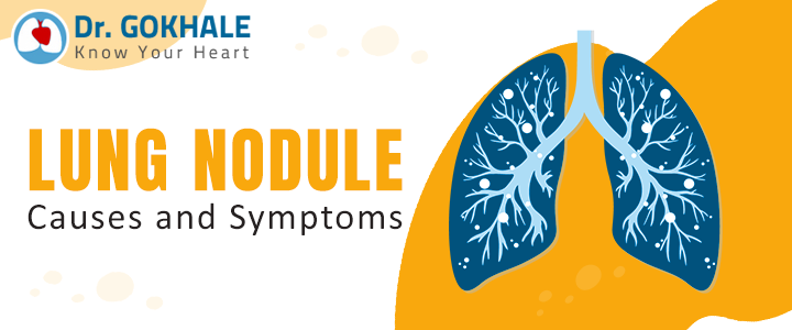 Lung Nodule Causes and Symptoms