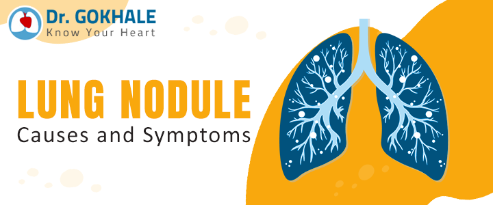 lung nodule causes and symptoms