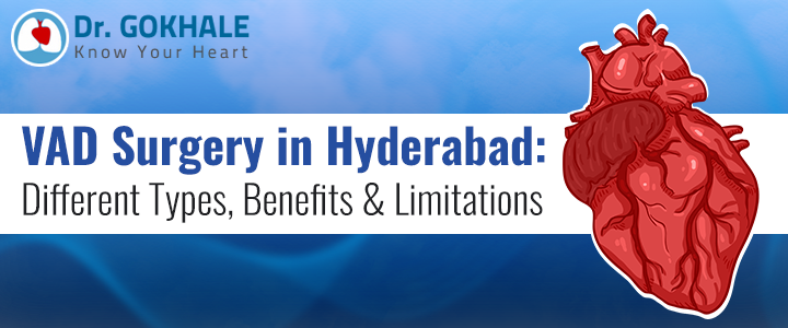 VAD Surgery in Hyderabad: Different Types, Benefits & Limitations