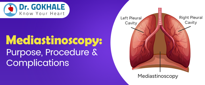 Mediastinoscopy: Purpose, Procedure & Complications