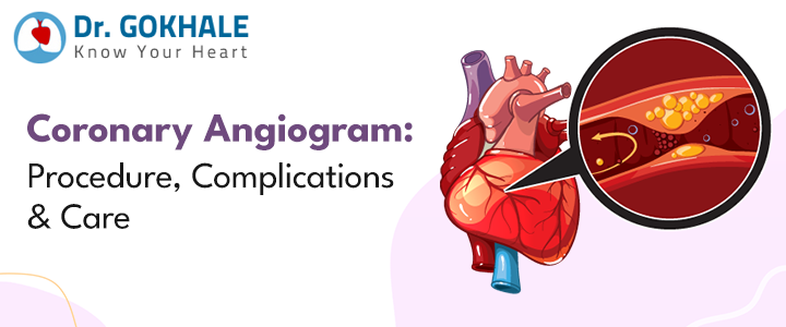 Coronary Angiogram: Procedure, Complications & Care: