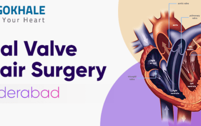 Mitral Valve Repair Surgery in Hyderabad