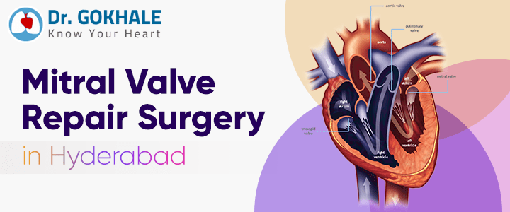 Mitral Valve Repair Surgery in Hyderabad | Dr. Gokhale