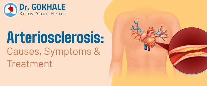 Arteriosclerosis: Causes, Symptoms & Treatment | Dr Gokhale