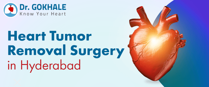 Heart Tumor Removal Surgery in Hyderabad | Dr Gokhale